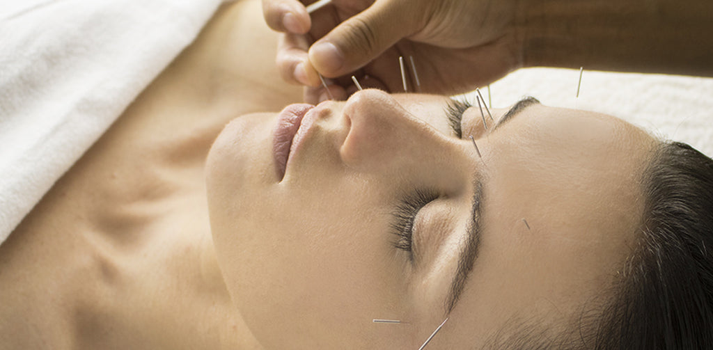 Cosmetic Acupuncture: How it gets real results